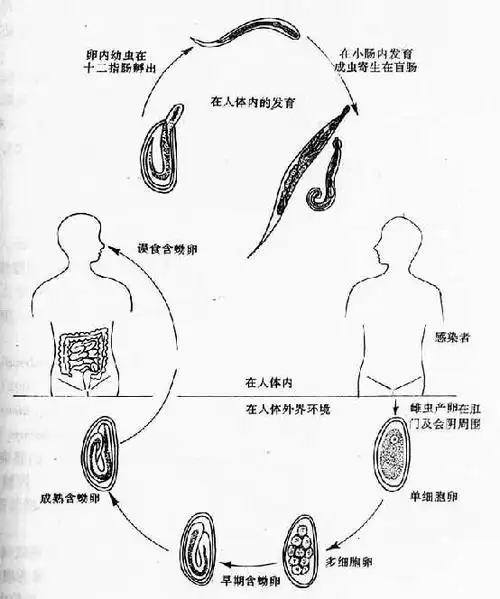 住肠线虫, i>enterobius vermicularis /i> (linnaeus,1758)又称蛲虫