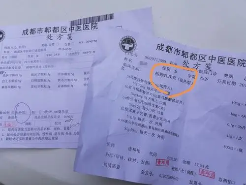 女子贴三伏贴皮肤灼痛起水泡 医生:起水泡才有效|瘙痒|皮炎|过敏_网易