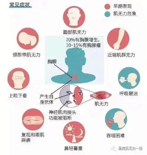 重症肌无力 五个字 却能毁掉一个家庭0101