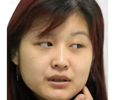 国字脸是最丑的脸型真的没有办法能解决国字脸吗