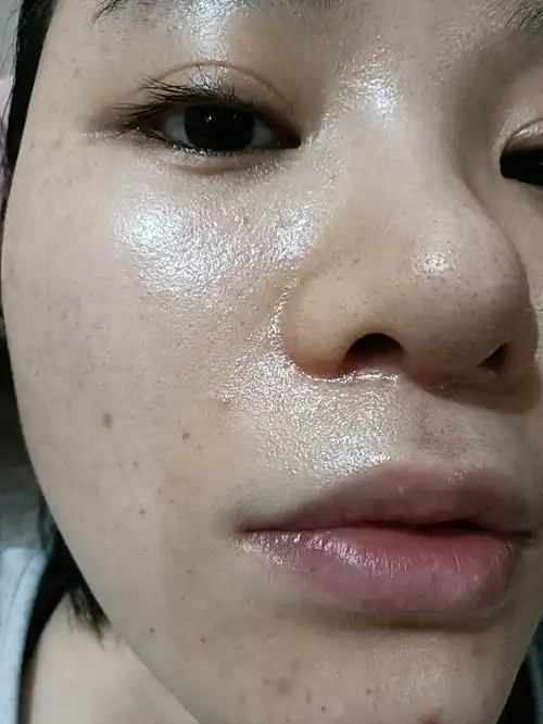 秋冬季节皮肤真的容易干燥敏感,随之而来的脱皮泛红也是让很多美宝贝