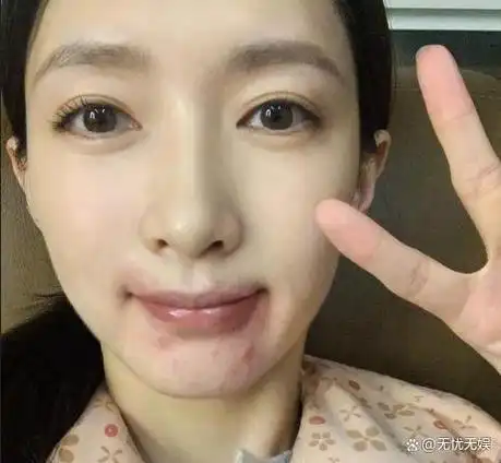 2023年7月,江疏影的素颜照片在网上引起了广大网友和粉丝的热议.