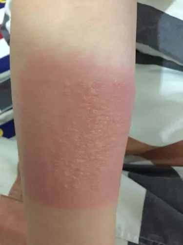 这个药膏摸行吗