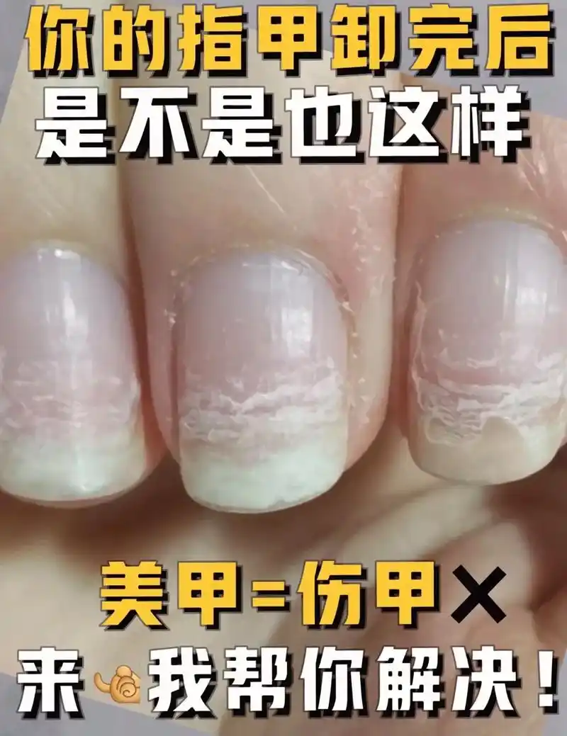 看到太多宝宝的指甲受到了伤害,最爱美 - 抖音