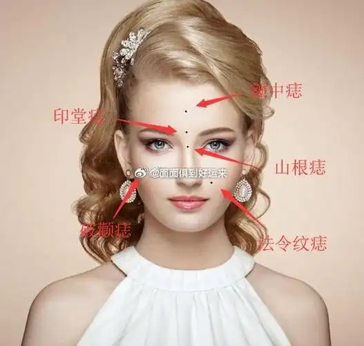 六颗痣,克害事业运势,希望你没有.