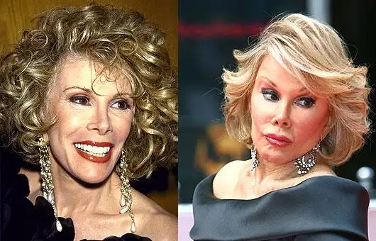 7. amanda lepore 阿曼达莱波雷整容部位:唇,隆乳,脂肪移植术.