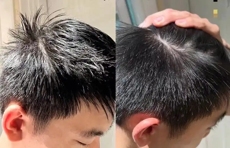 大学男同学头发超级油,还洗不干净,有啥简单高效一步到位的控油洗发水