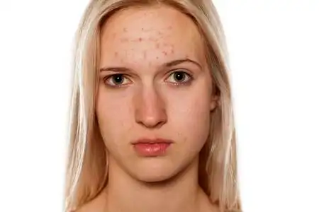 护肤问题图片-护肤问题素材-护肤问题插画-摄图新视界