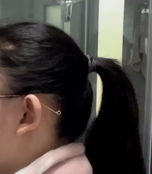 这算圆脑袋还是扁脑袋