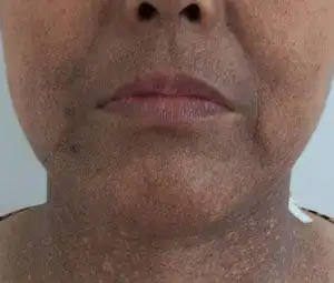 如果发现自己的脸色暗沉,尤其是额头都弥漫着一种黑气,说明你的肝脏不