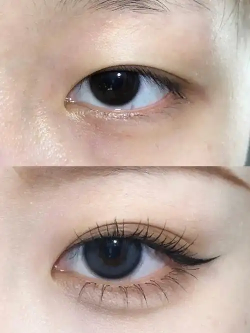 内双妈生双眼皮贴法隐形自然调整眼型