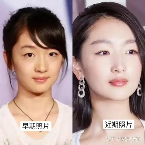 从山楂树到少年的你周冬雨的肿泡眼下垂眼反成个人特色