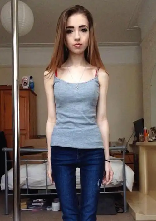 体重秤上的女大学生,瘦到只有50斤,一根钢管救了她!