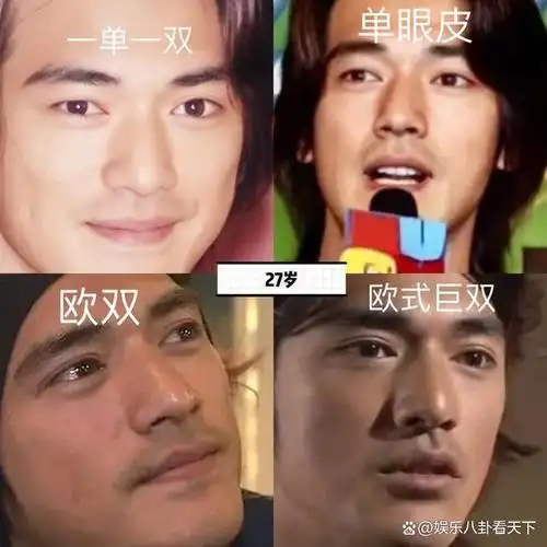回顾割了双眼皮判若两人这5位男星一刀划得太惊艳颜值大变