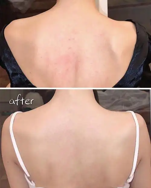 身体美白哪家强?看这!