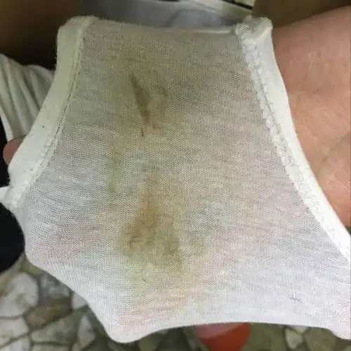 沟通解决!每个月排卵期都有褐色分泌物"助孕公司"-第2张图片-凯飞博客