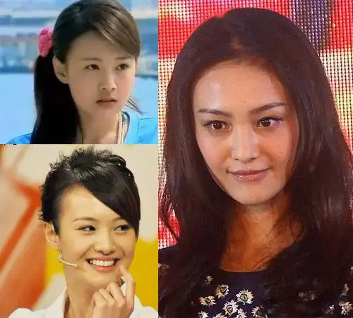 郑爽整容前(左)后(右)对比
