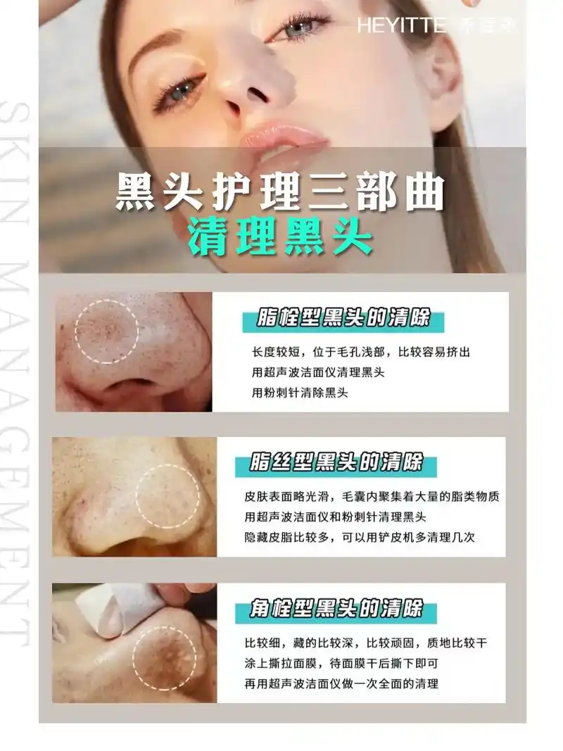 正确去黑头的方法!#美容院加盟 这份纯干货宝藏祛黑头养护攻 - 抖音