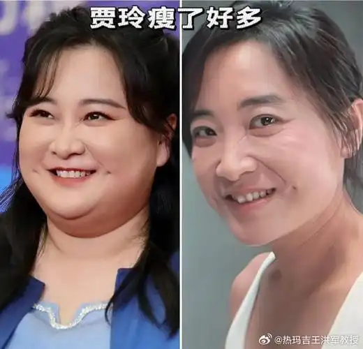 贾玲瘦了100斤