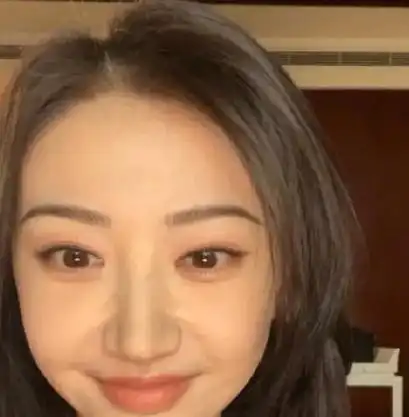 景甜疑似整容失败面部沟壑十分明显近照被指像中年妇女