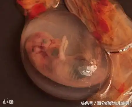 询问了其他医院的护士,他们表示还有更加残忍的,就是将引产出的胎儿