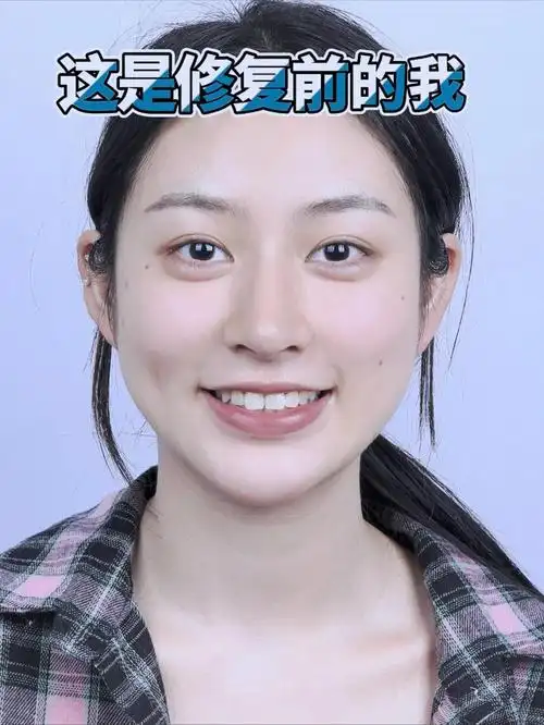 n视觉上拉长了脸型,
从圆脸变成了鹅蛋脸,
小虎牙增添了面部灵