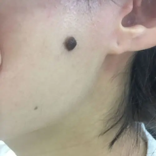 大连市皮肤病医院怎么样?