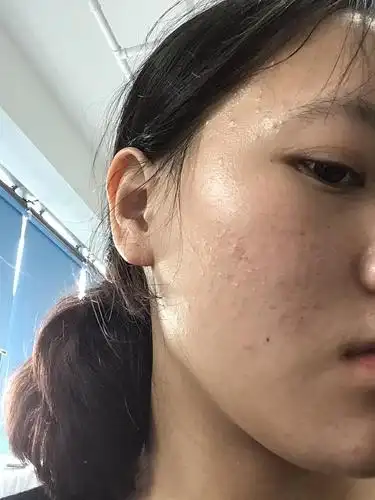 脸真的又丑又脏又油