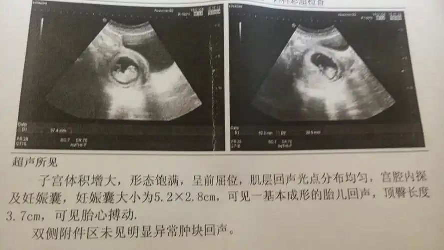 有没有会看的 怀孕70天了 是男孩还是女孩