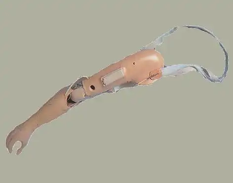 肌电和索控混合型上臂假肢