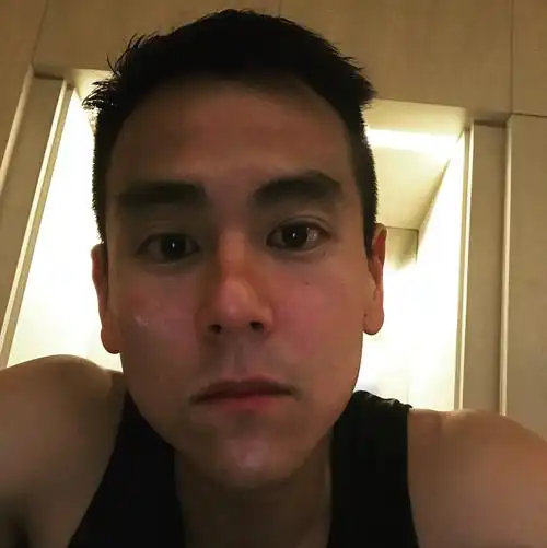 彭于晏又晒鼻孔视角自拍,脸颊的小粉红是怎么回事?