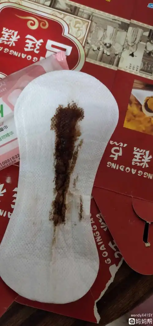 一生理性褐色白带 生理性的褐色白带大多数发生在女性排卵期,褐色其实