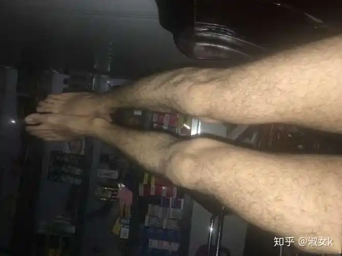 男生如何看待腿毛多的女生?
