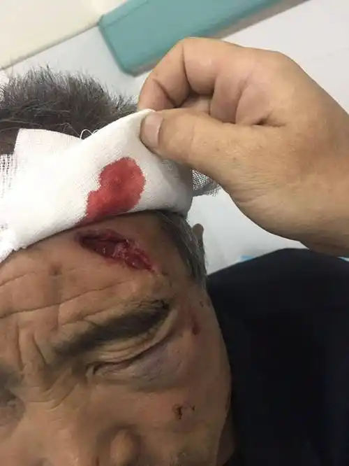 急寻目击证人!一摩托车肇事后逃逸 致56岁老人头部受伤