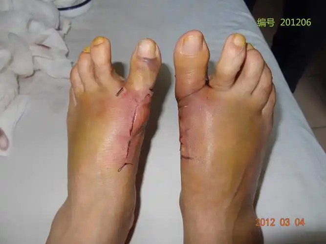 2012年2月手术图片 - 好大夫在线