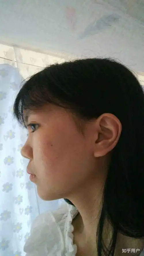 塌鼻子的女人面相真的不好吗>> 文章内容 >> 鼻梁扁平的男人面相代表