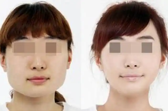 三分钟教你如何拯救大饼脸