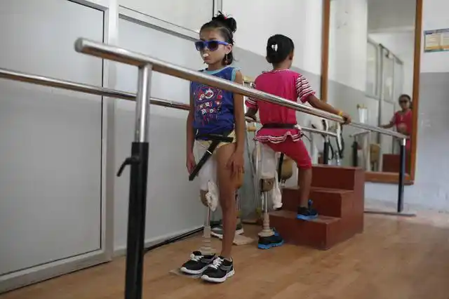 一对相同遭遇不同命运的截肢女孩坚强的让人落泪