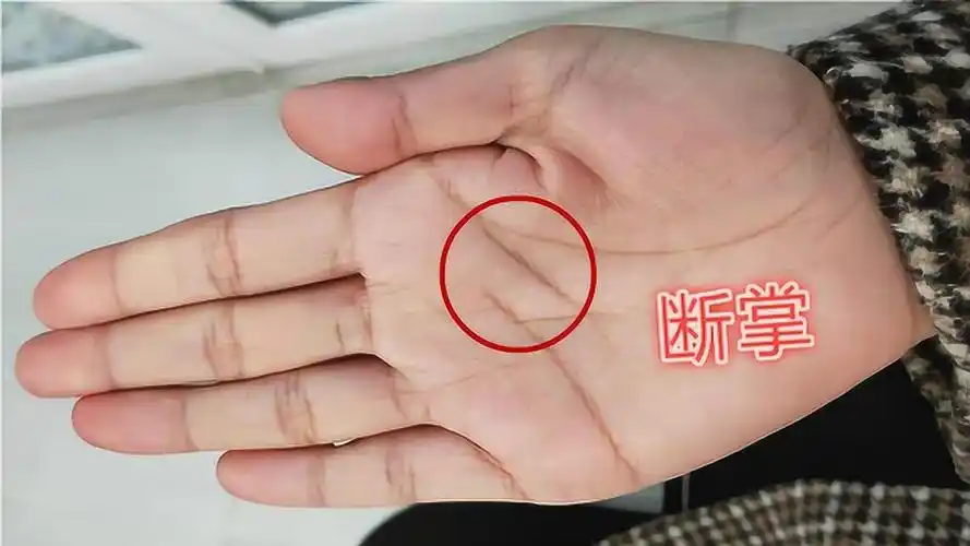 女人断掌过房养断掌的人婚姻线怎么看女人右手断掌好吗