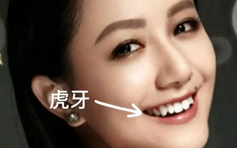 长虎牙的女生财运跟姻缘怎么样?