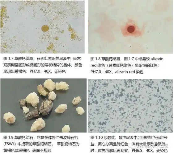 尿液结晶形态汇总