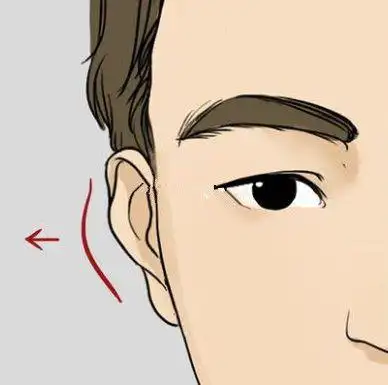 "轮飞廓反",也称"反骨耳".意思是耳轮包不住耳廓,耳廓非常突出.