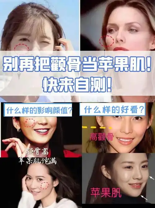 73自测环节:首先搞清楚苹果肌和颧骨的区别苹果肌位于眼睛下方2公分