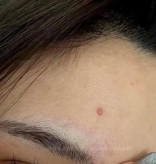 女友被烫伤,故意示弱胸前惹争议