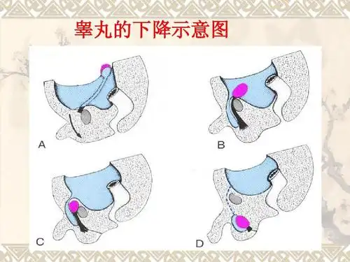 男性生殖系统超声诊断ppt课件