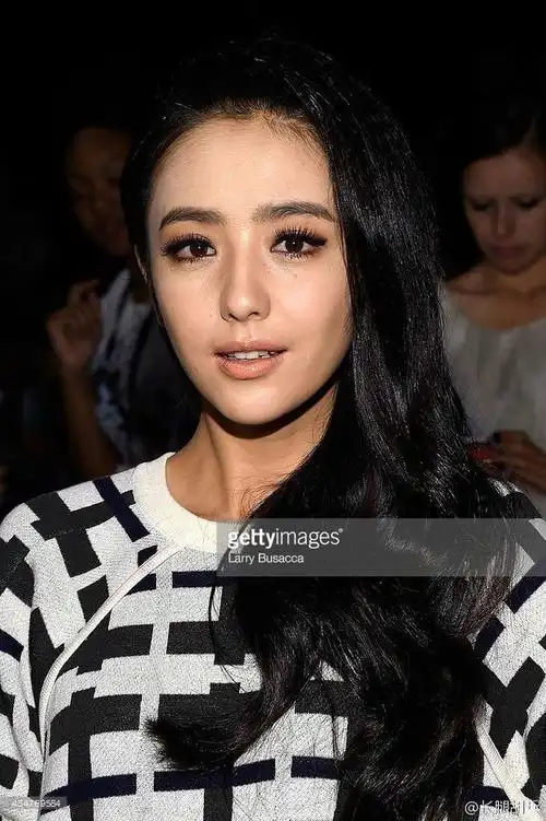 佟丽娅,肤色暗沉问题很严重,眼睛下方的也有了不少斑