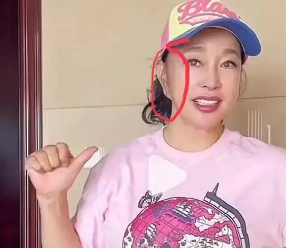 看完刘晓庆的耳朵,你还敢整容吗?