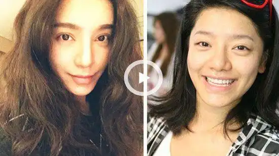 江映蓉疑整形变脸,江映蓉整形对比照片