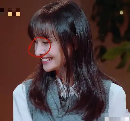 郑爽的鼻子垫高了多少?对比楚雨荨时期,化身一言难尽的格格巫?