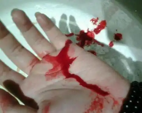 梦见老公被杀流血